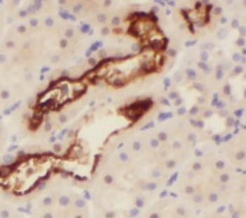 NCKAP5L Rabbit Polyclonal Antibody