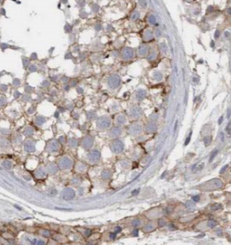 KIFAP3 Antibody