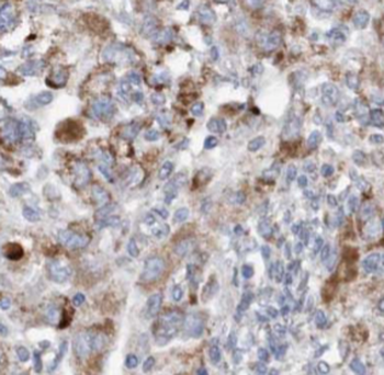 KNG1 Antibody