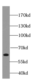 KNG1 Mouse Monoclonal Antibody