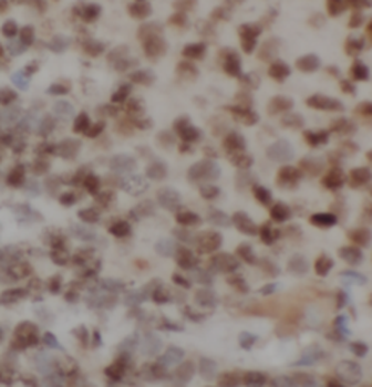 KNG1 Mouse Monoclonal Antibody