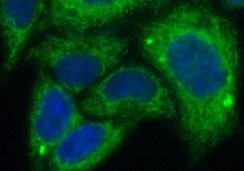 LATS2 Antibody