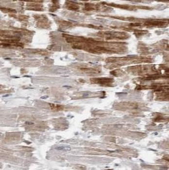 LATS2 Antibody