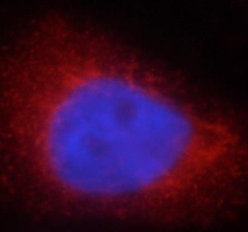 LDHA Antibody