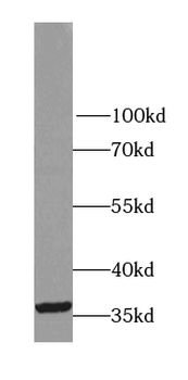 LDHC Antibody