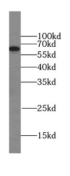 EIF2D Rabbit Polyclonal Antibody
