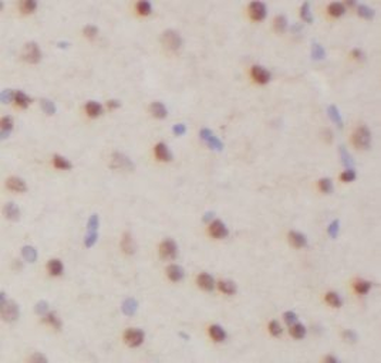 LIN28B Antibody