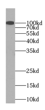 SLC39A6 Antibody
