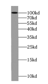 LONP1 Mouse Monoclonal Antibody