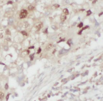 LONP1 Mouse Monoclonal Antibody