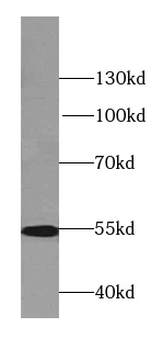 LPCAT1 Antibody