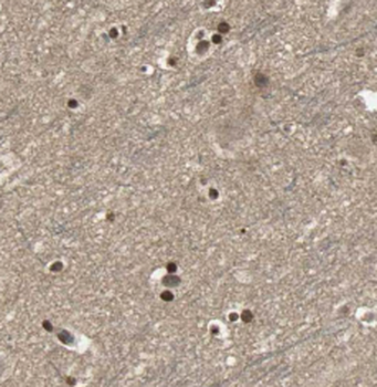 CACNA1C Antibody