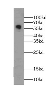 MAOB Mouse Monoclonal Antibody