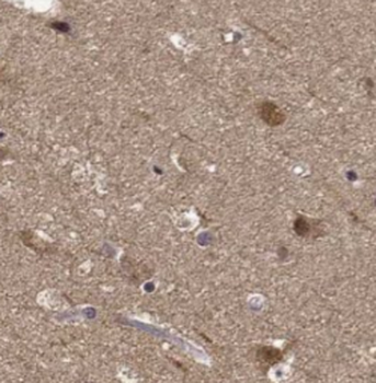 MAOB Mouse Monoclonal Antibody
