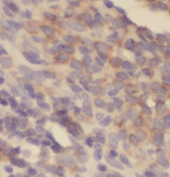 MCL1 specific Rabbit Polyclonal Antibody