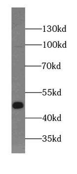 MEF2C Specific Rabbit Polyclonal Antibody