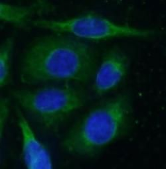 ERRFI1 Antibody