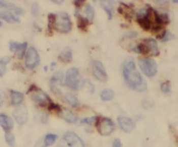 IMMT Antibody