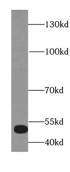 KAT8 Rabbit Polyclonal Antibody