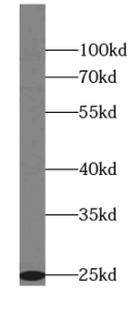 Mtco2 Antibody
