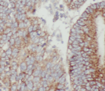 Mtco2 Antibody