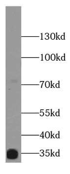 MUC8 Rabbit Polyclonal Antibody