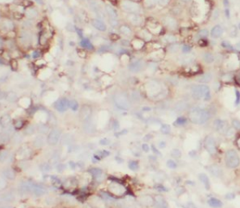MUC8 Rabbit Polyclonal Antibody