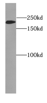MYH2-specifc Antibody