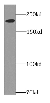 MYH6 Antibody