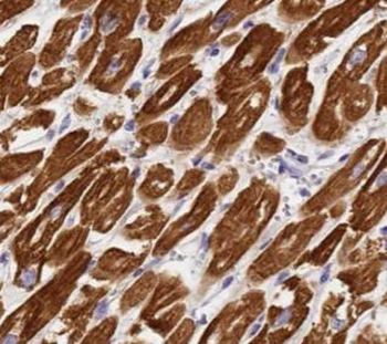 MYH7 Antibody