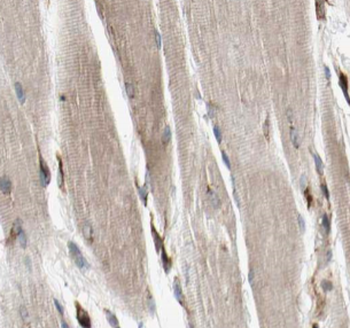 MYOM1 Antibody