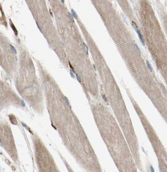 MYPN Antibody