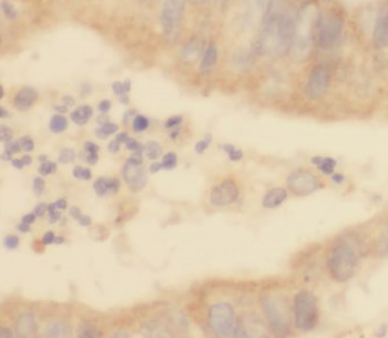 SSNA1 Antibody