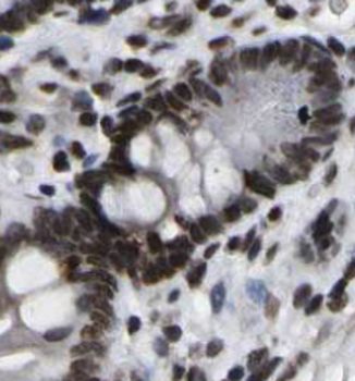 NAPRT Antibody