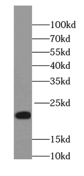 NCALD Antibody