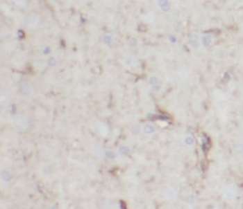 NCALD Antibody