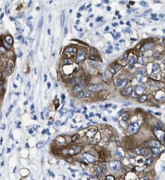 GNAS Mouse Monoclonal Antibody