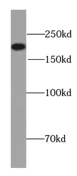 NEFH Mouse Monoclonal Antibody