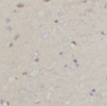 NEFH Mouse Monoclonal Antibody