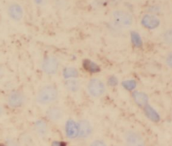 NEFM Antibody