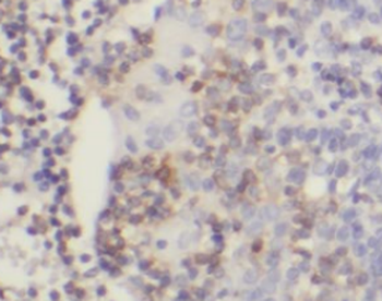 NINJ2 Antibody