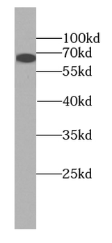 SLCO1C1 Antibody