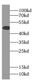 SLC22A16 Antibody