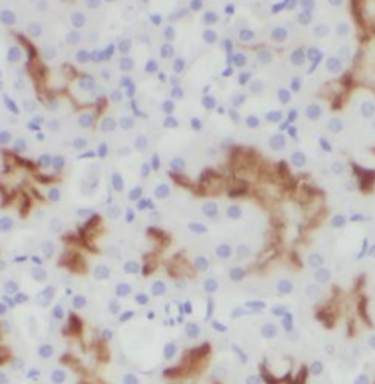 SLC22A5 Antibody