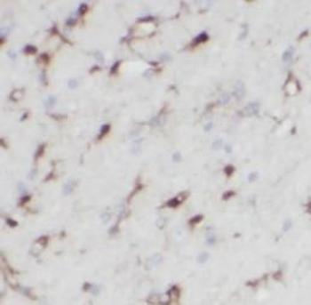 TENM1 Antibody