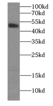 HCRTR1 Antibody