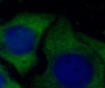 ORM2 Antibody