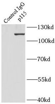 USO1 Antibody