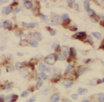 USO1 Antibody