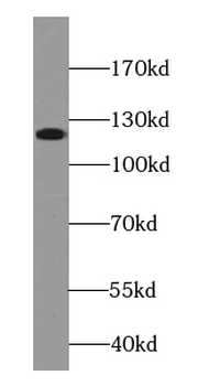 CTNND1 Mouse Monoclonal Antibody